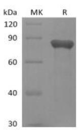 SDS-PAGE (GAS6-383H).jpg